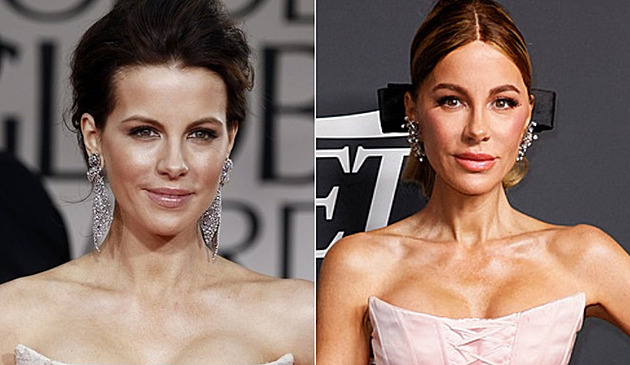 VIP a proměny. Přehnali to s plastikami a přestávají si být podobní