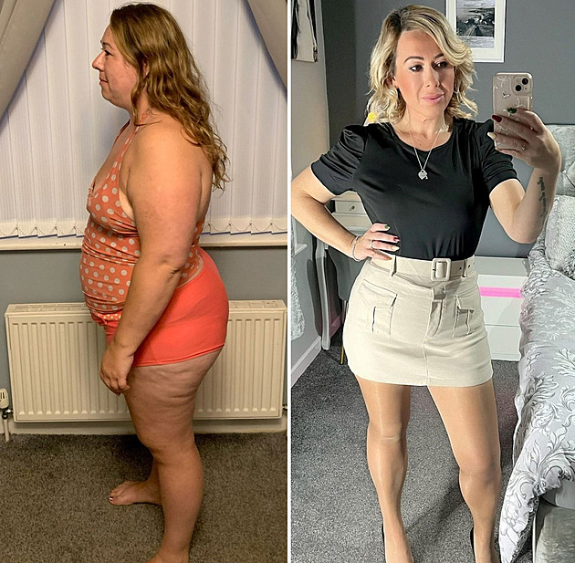 Styděla se za ni vlastní dcera, tak žena radikálně zhubla